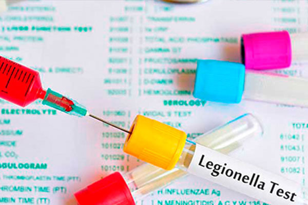 prevencion-de-legionella